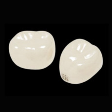 2구치부(2nd Molar): 낱개